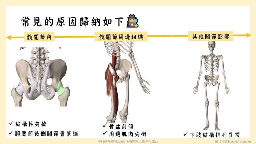 hip-stiffness-movement-control Facebook 原始貼文照片 3