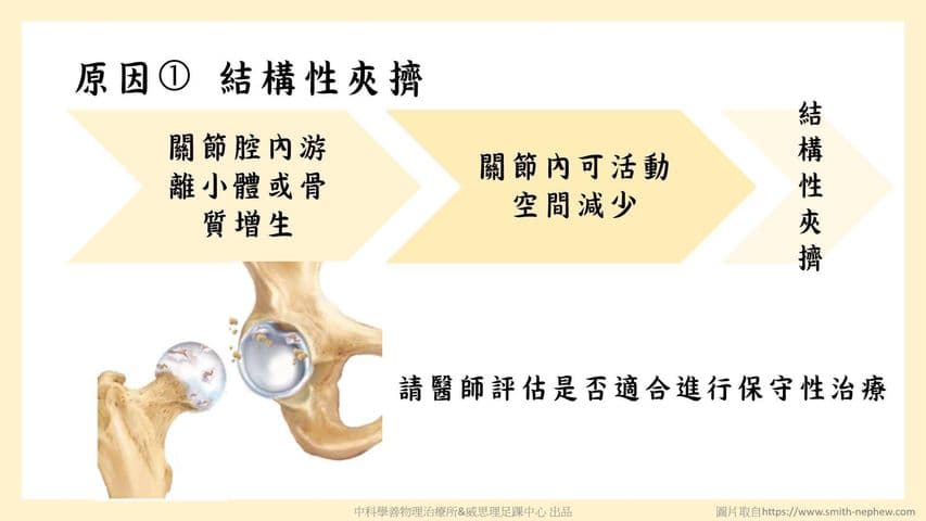 hip-stiffness-movement-control Facebook 原始貼文照片 4