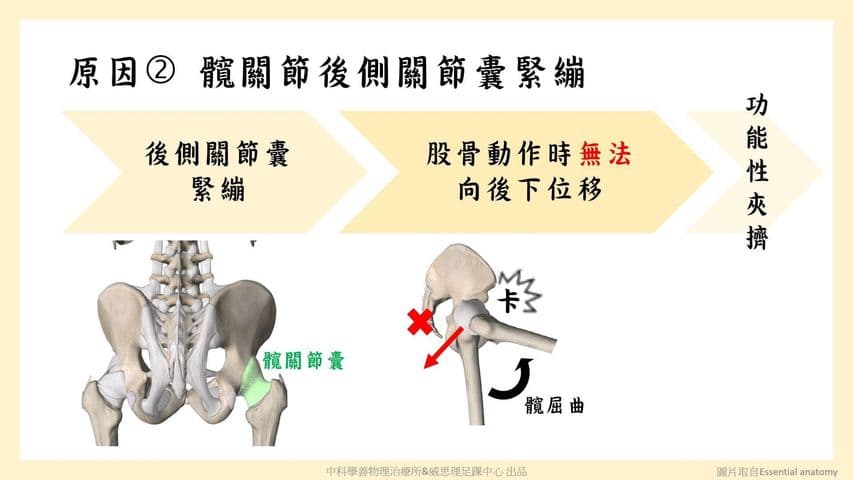 hip-stiffness-movement-control Facebook 原始貼文照片 5