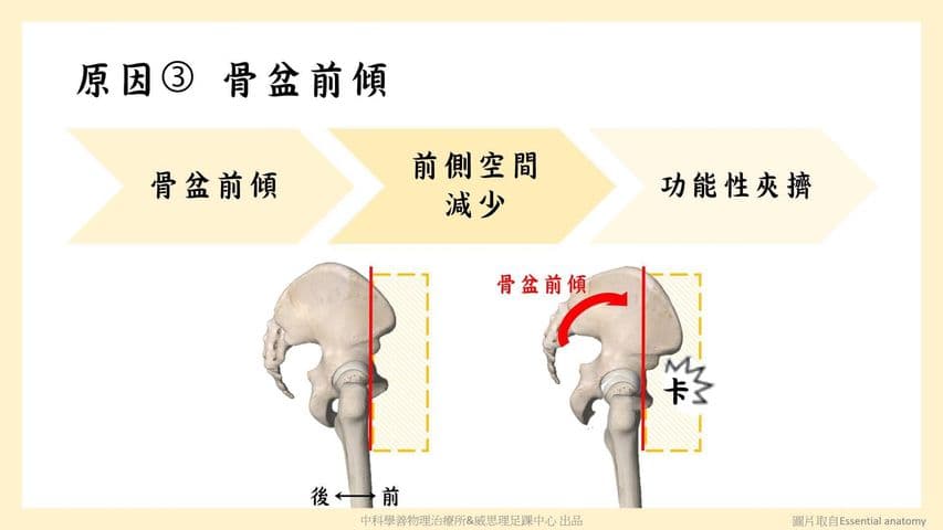 hip-stiffness-movement-control Facebook 原始貼文照片 6