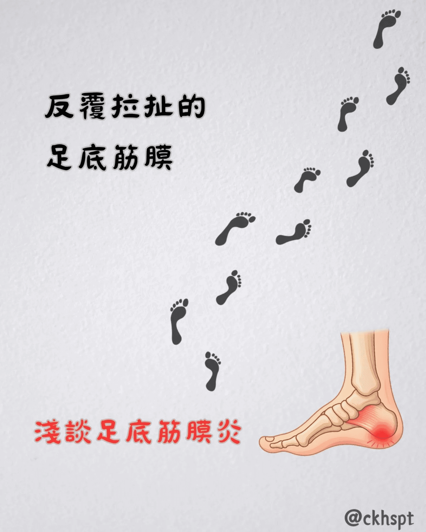 足底筋膜炎原始 Facebook 圖文 1
