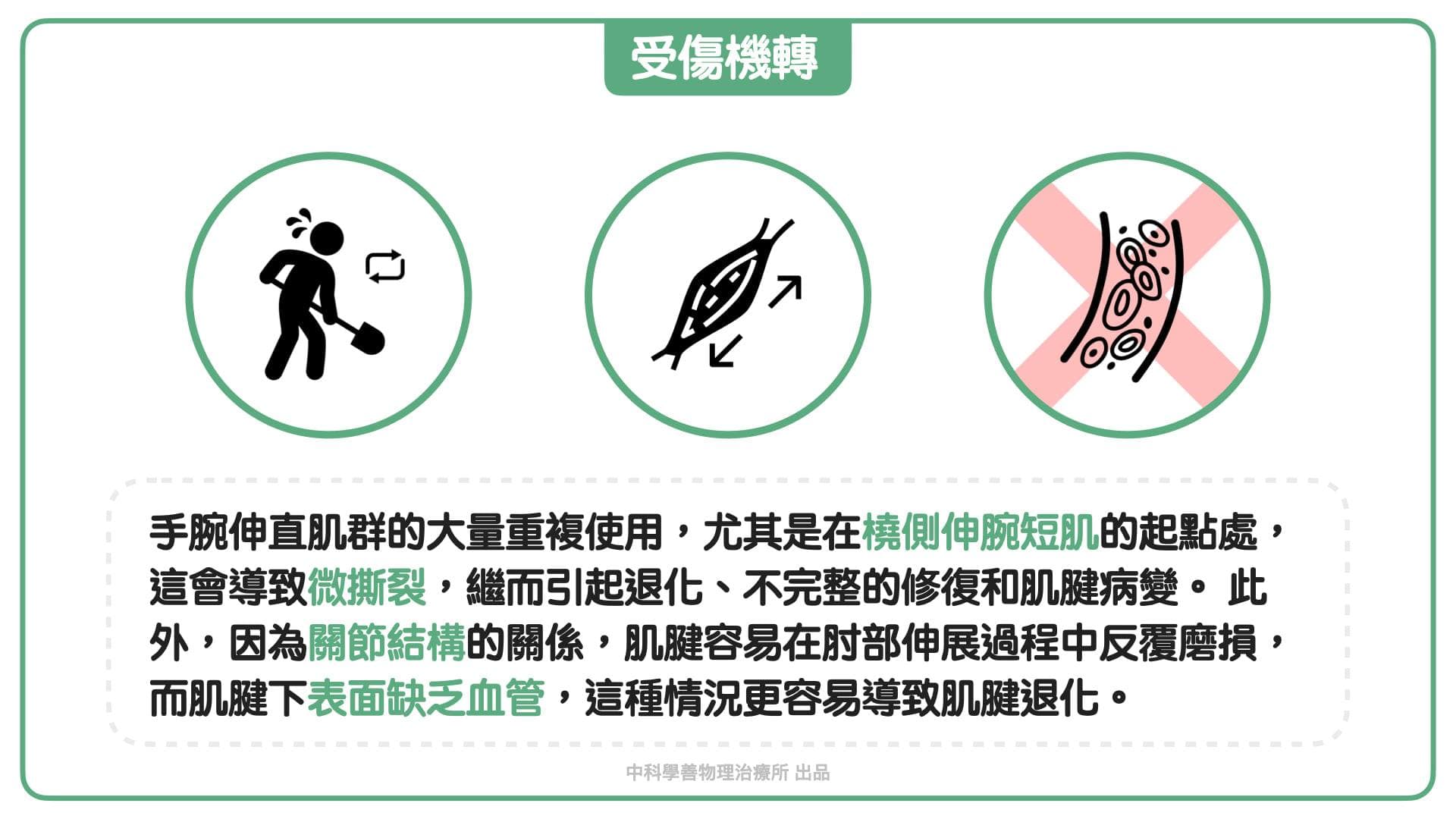 tennis-elbow-assessment Facebook 原始貼文照片 5