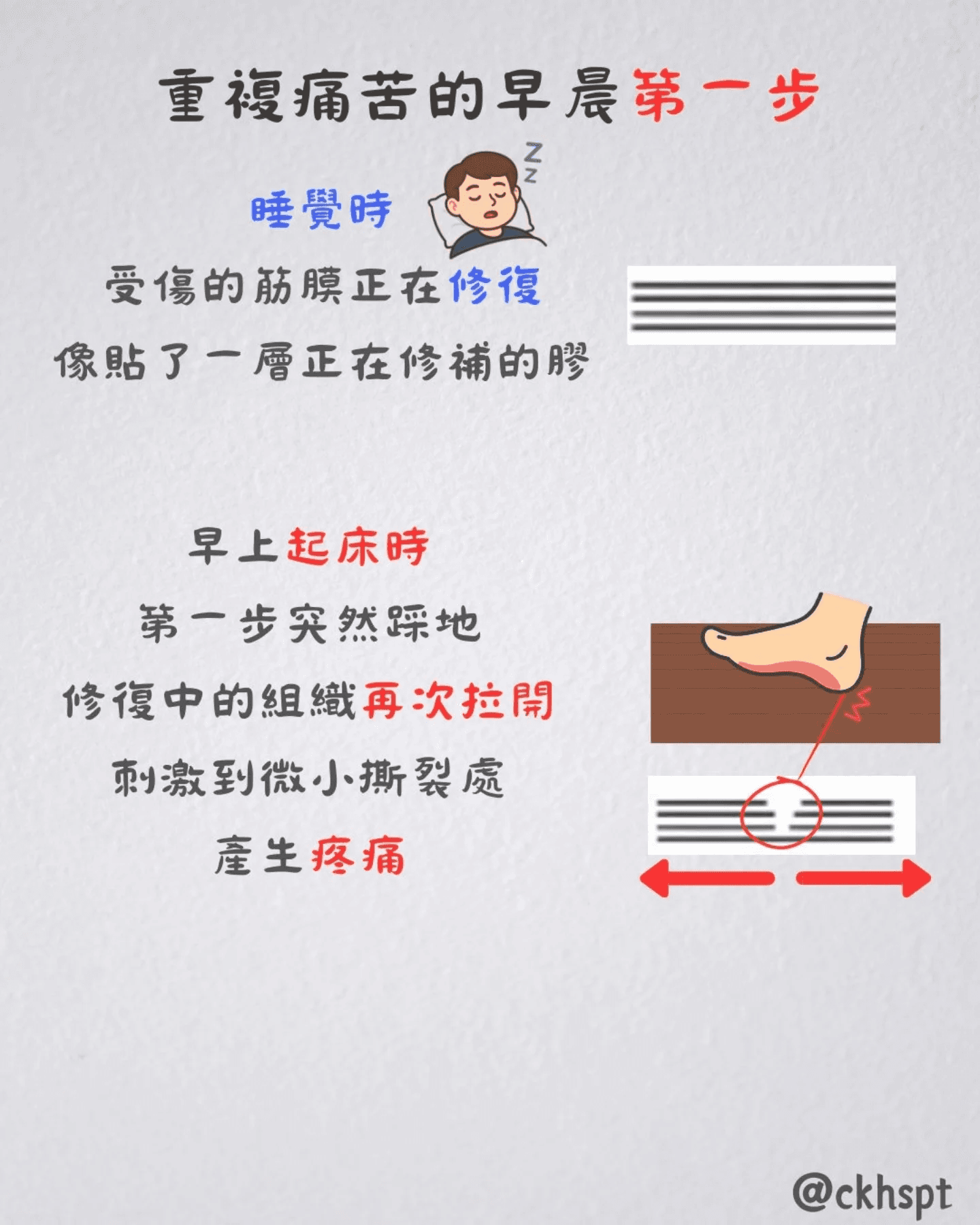 足底筋膜炎原始 Facebook 圖文 2
