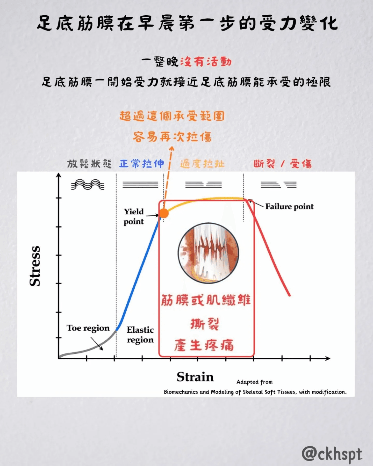 足底筋膜炎原始 Facebook 圖文 3